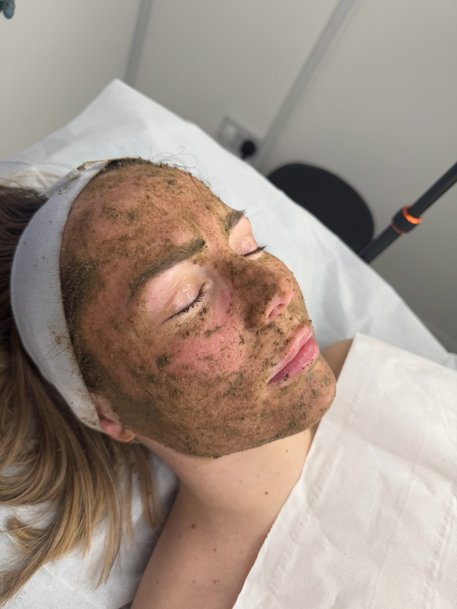 CO2 Fractional Laser