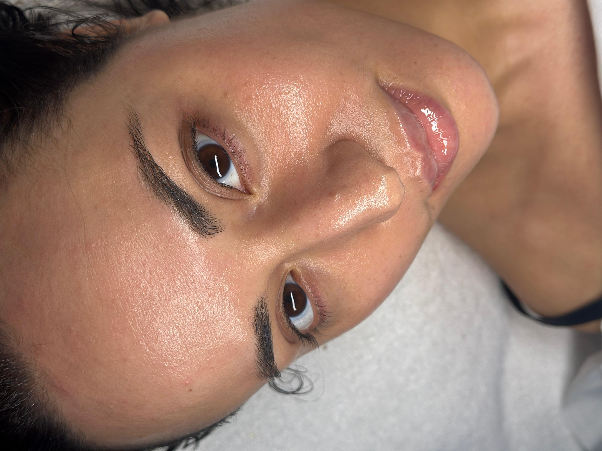 Advanced Skin Rejuvenation & Fine Lines