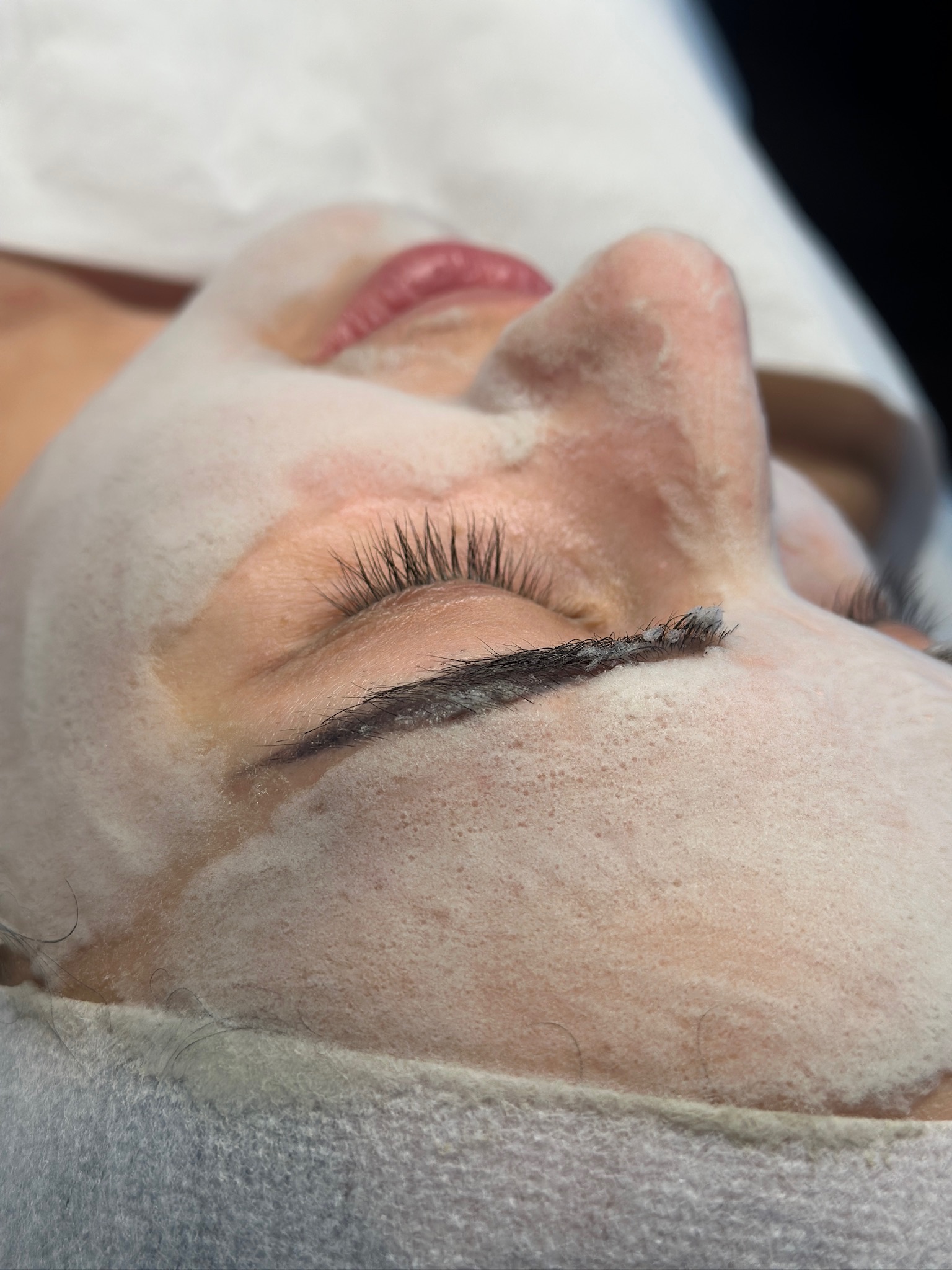 Tone, Glow, Redness & Acne Repair