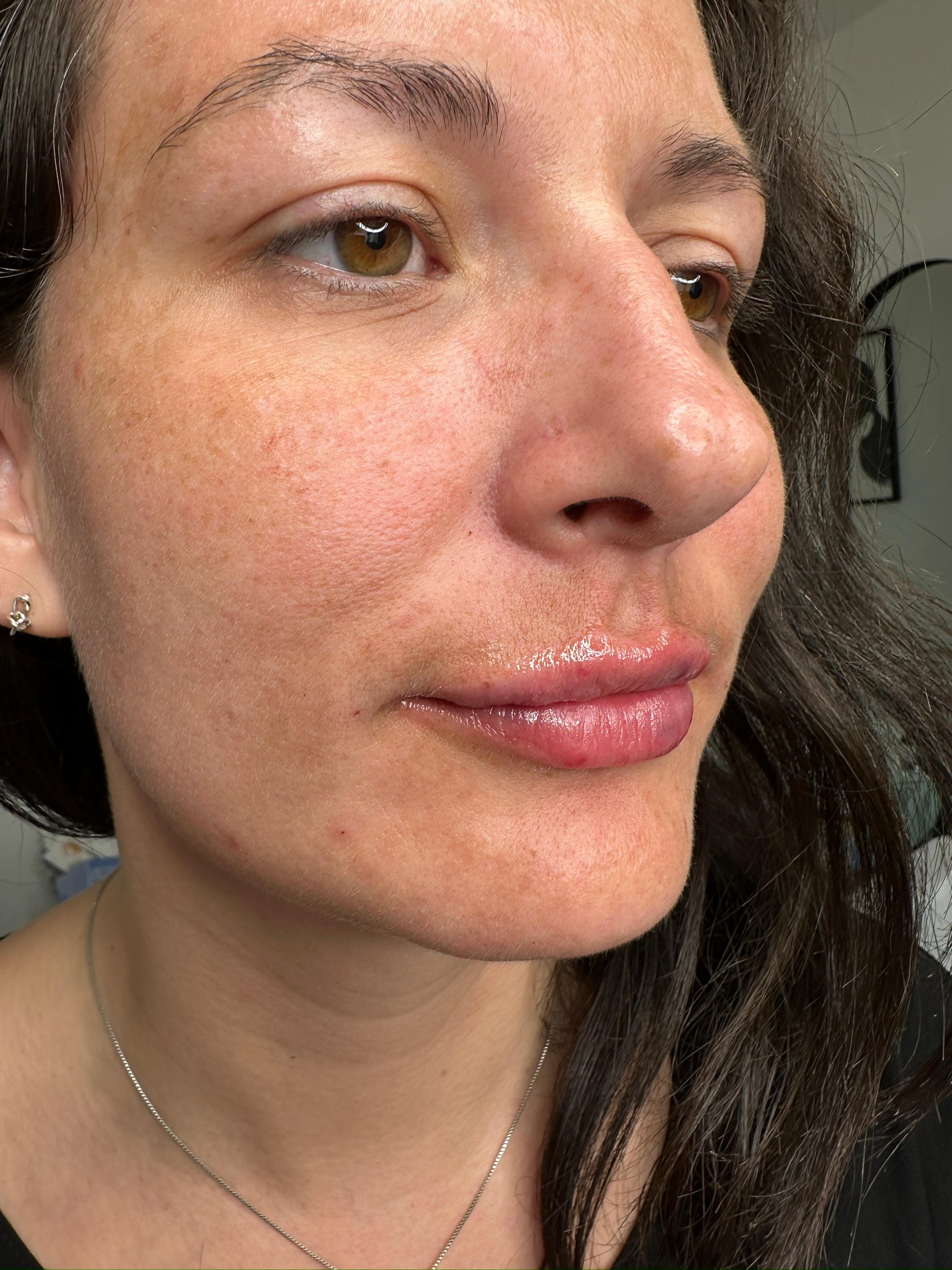 Anti-wrinkle